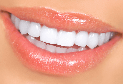 Bollywood Smile (Full Smile Makeover)