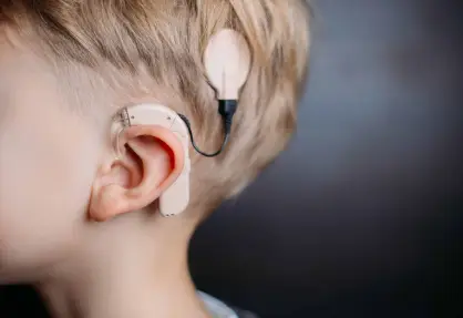 Cochlear Implant Surgery