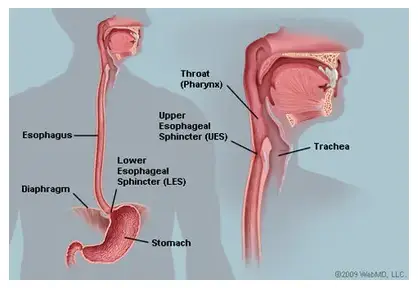 Esophageal (Food Pipe) Surgery