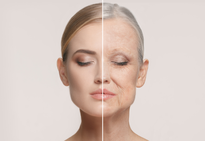 Facelift (Rhytidectomy) in India