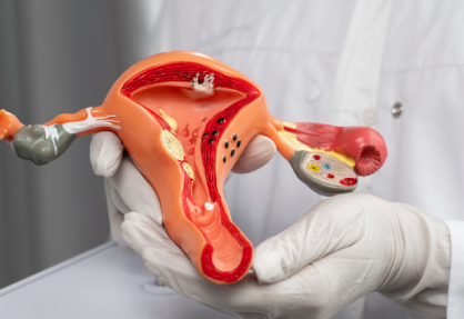 Hysterectomy Uterus Removal Surgery