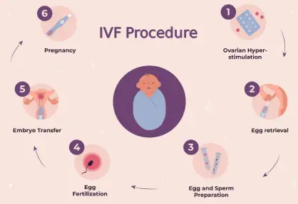 IVF Procedure