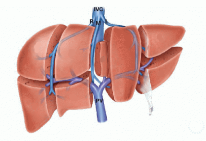 Liver Resection (Hepatectomy)