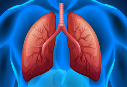 Lung Transplant
