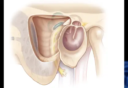 Mastoidectomy