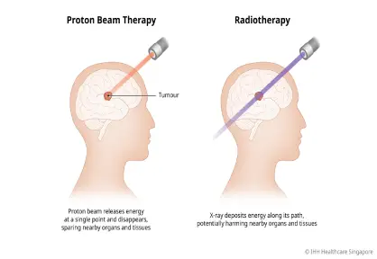 Proton Therapy