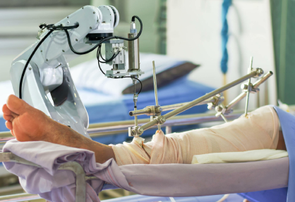 Robotic Knee Replacement